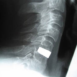 Behandlungsspektrum - Rücken & Wirbelsäule